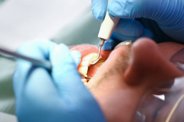 Best Pediatric Emergency Dentist in Prescott, WI
